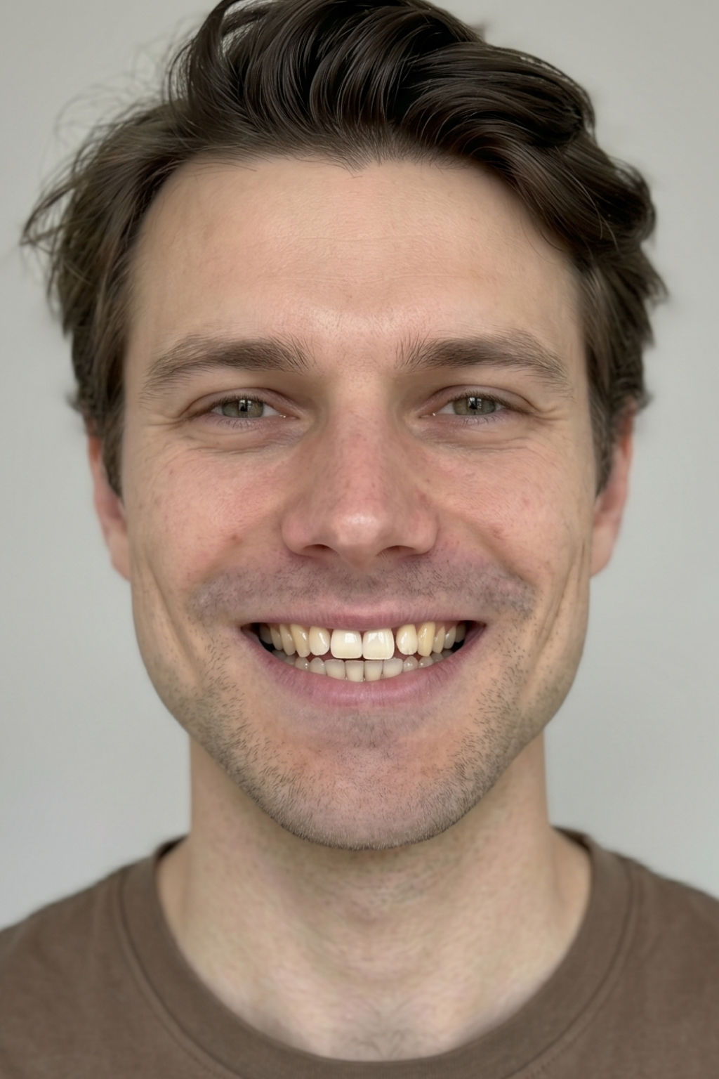 Generated portrait labelled Before.